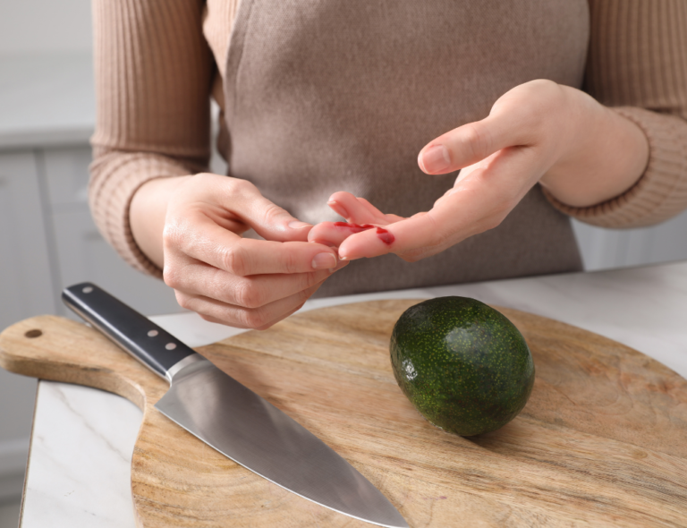 Een diepe snee in een vinger, veroorzaakt door slechte snijtechniek met een keukenmes. Dit illustreert het belang van veilige snijtechnieken en de juiste greep. Lees ons artikel voor essentiële tips en technieken om snijwonden te voorkomen en veilig te snijden in de keuken.